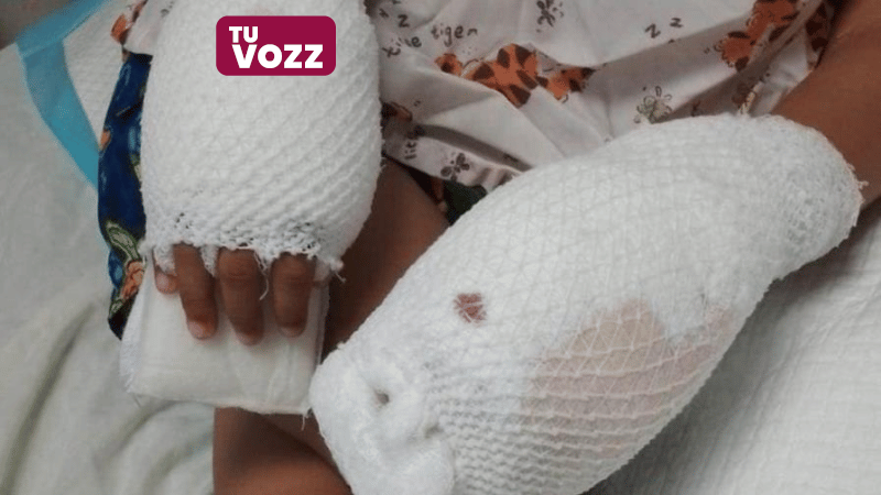 Imputada de Maltrato Infantil Recibe Prisión Preventiva Tras Causar Quemaduras a Su Hijo de Cuatro Años - Imagen
