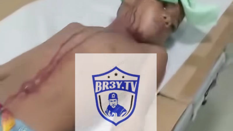 Video: Indignación en el Hospital Moscoso Puello: Niño herido no recibe atención por falta de personal en emergencia - Imagen